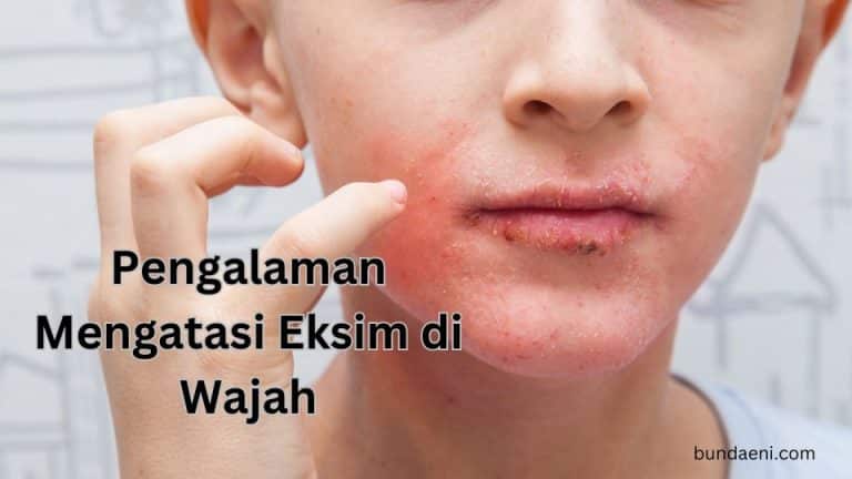 eksim di wajah